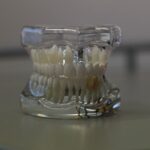 Dentures with Medicaid • Cost and coverage